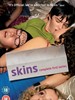 #皮囊/Skins(2007)